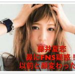 藤井夏恋は鼻や顔変わった！整形疑惑は目まで？FNSと比較画像は？